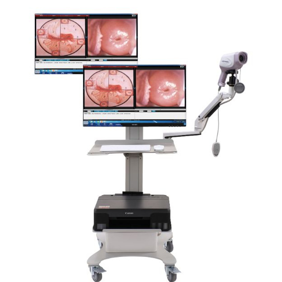 Mesin Kolposkop Digital HD 4K  - Women'S Health & Wellness Center ulasan dan harga